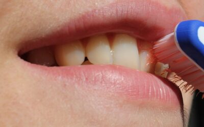 What is Gingivitis?