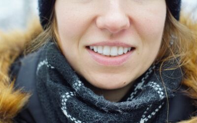 What should you not eat after teeth whitening?