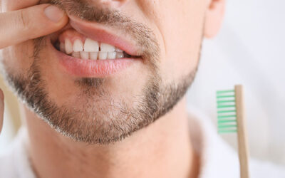 Understanding Bleeding Gums: Causes, Prevention, and Professional Care