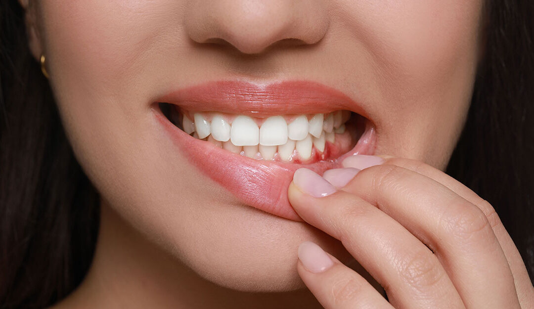 Top 7 Signs You Might Have Periodontal Disease