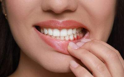 Top 7 Signs You Might Have Periodontal Disease