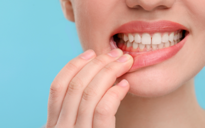 Do I Have Gingivitis or Periodontitis? A Simple Guide to Understanding Your Gum Health