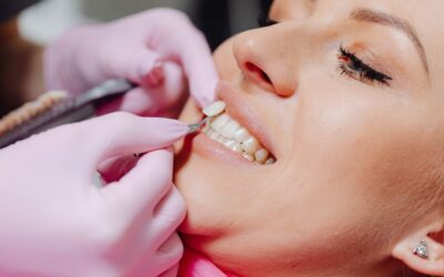 Porcelain Veneers: A Step-by-Step Guide to Your Ultimate Smile Makeover in The Woodlands